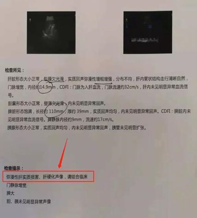 50歲河南男子堅持每晚“喝2兩白酒”，如今身體怎么樣了？